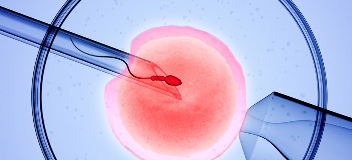 Клиника высоких репродуктивных технологий «Тонус МАМА» осуществляет набор доноров яйцеклеток!