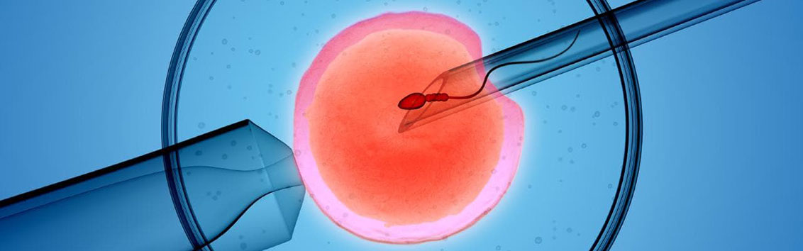 Программа с использованием донорской спермы